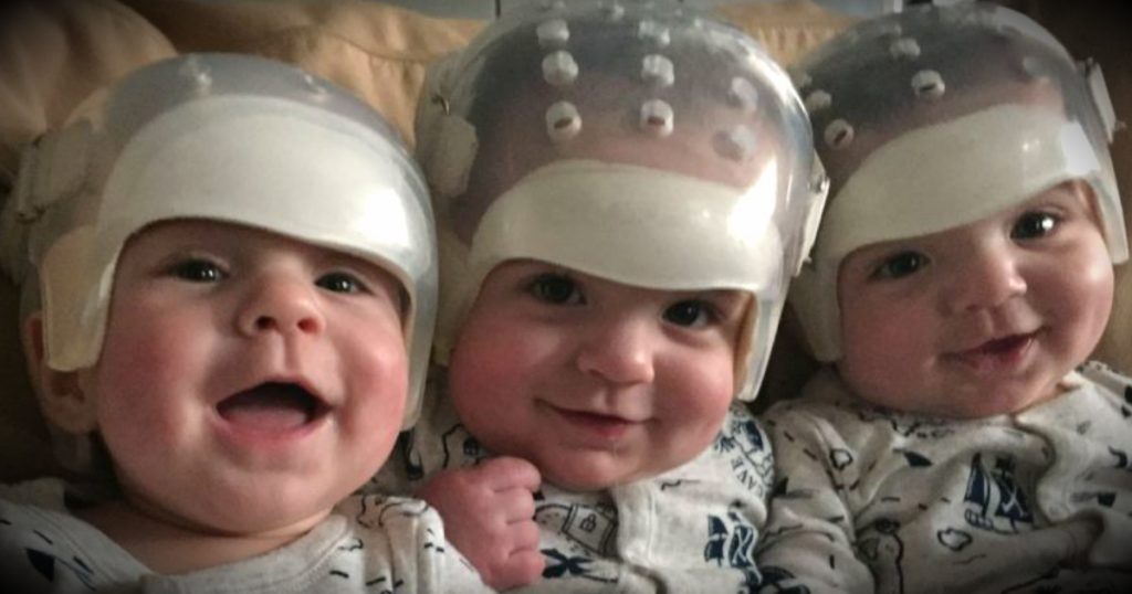 Triplets Born with Same Rare Birth Defect, Then Make Medical History